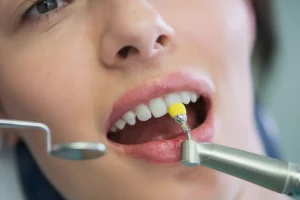 dental cleanings for sensitive teeth