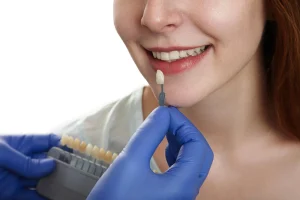 dental veneers for natural looking smile