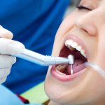 What Happens During a Professional Dental Cleaning Appointment