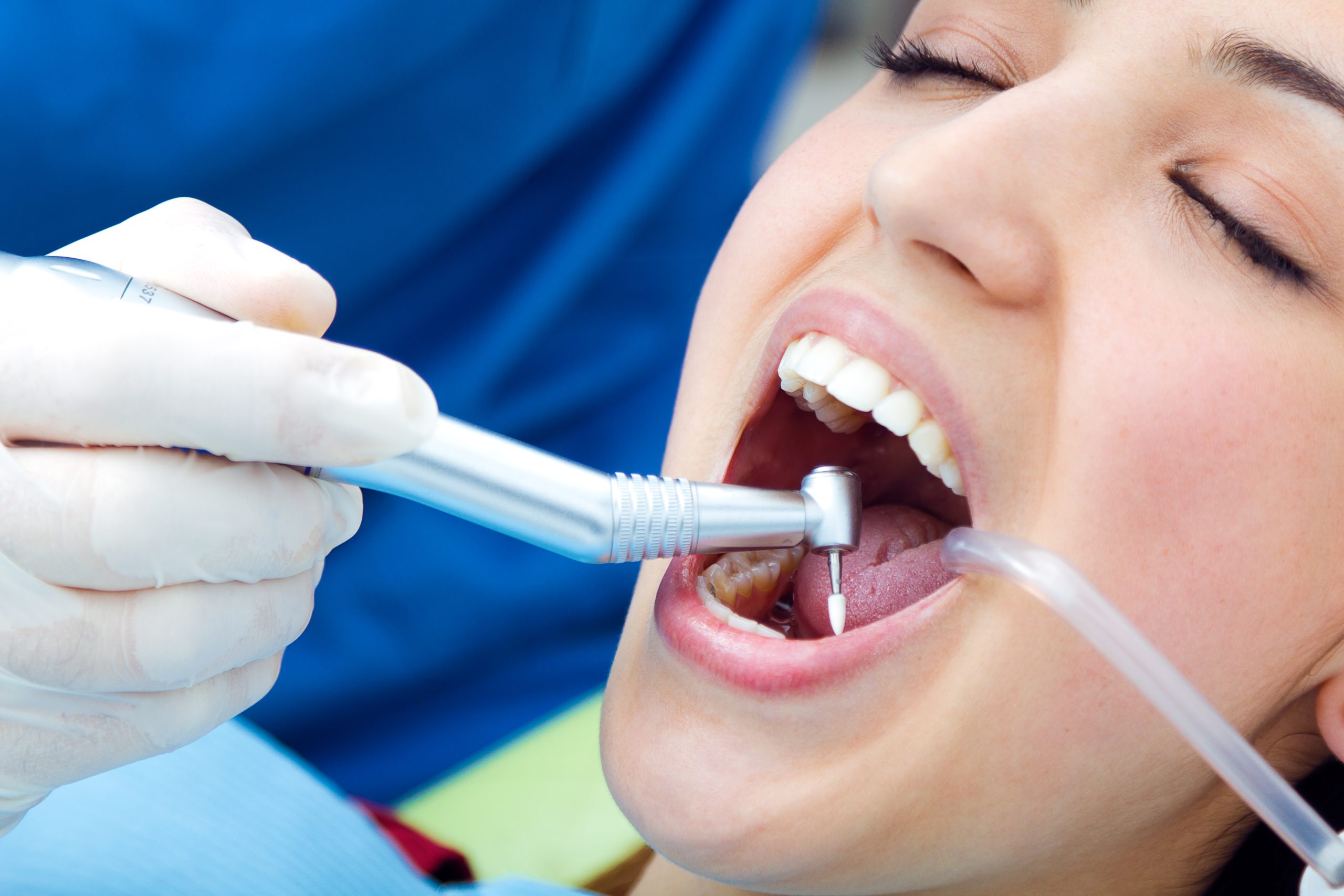 What Happens During a Professional Dental Cleaning Appointment